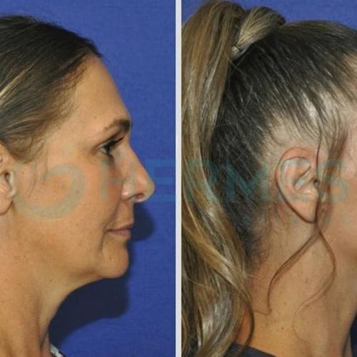 Before after photos of our patients 2